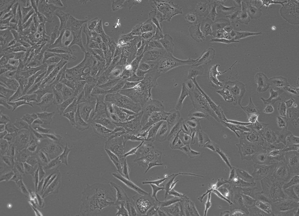Immortalized Cells Supporting Disease Modeling