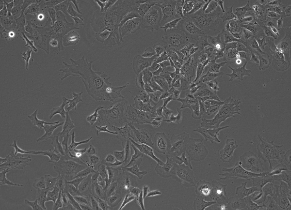 Immortalized Cells Supporting Disease Modeling