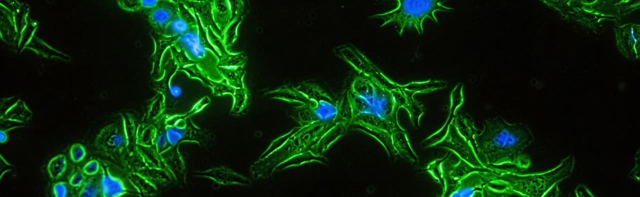 Immortalized Cells Supporting Disease Modeling