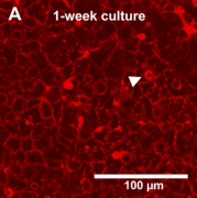 Genomic and Hepatotoxicity Research of Hepatocellular Carcinoma Cell Line (HepG2 Huh7 Hep3B)
