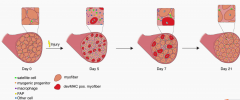 Skeletal Muscle Satellite Cells and Macrophages Regulate Skeletal Muscle Regeneration