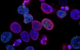 Immortalized Cell Lines