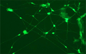 AcceGen Reporter Stable Cell Lines