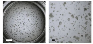 Research Progress of Alveolar Epithelial Type II Cells in Idiopathic Pulmonary Fibrosis