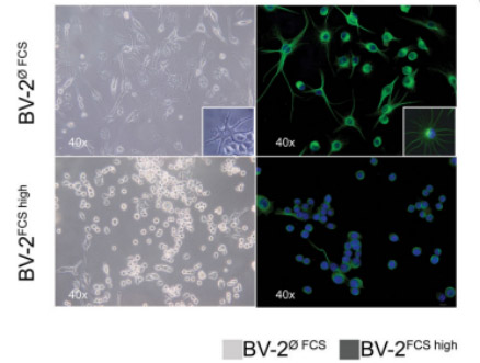 Different cell morphology phenotype of the murine microglial BV-2cell line