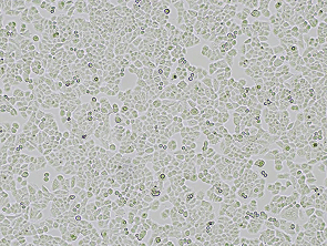 Brightfield micrograph of NCI-H460, showing adherent growth.