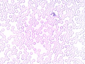 Human PB Leukocytes