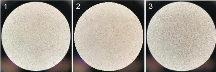 Vero cell growth pictures in different media on day 4