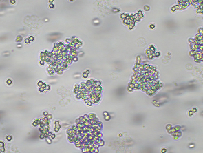 Brightfield micrograph of 1301, showing suspension growth, 10X magnification.