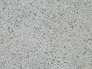 Brightfield micrograph of 143B, showing adherent growth, 4X magnification.