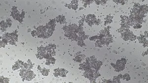 BJAB cell line|AcceGen