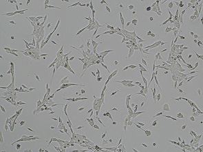 Brightfield micrograph of 4T1, showing adherent growth.