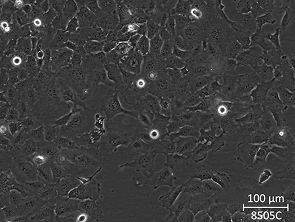 Brightfield micrograph of 8505C, showing adherent growth.