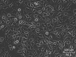 Brightfield micrograph of 92.1, showing adherent growth.