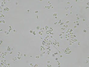 Brightfield micrograph of A-427, showing adherent growth, 4X magnification.