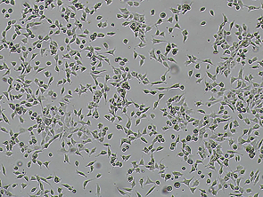 Brightfield micrograph of A-673, showing adherent growth.