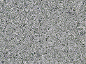Brightfield micrograph of ATDC5, showing adherent growth.