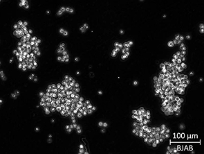 Brightfield micrograph of BJAB, showing suspension growth.