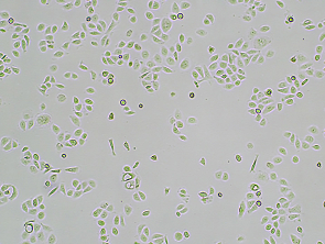 Brightfield micrograph of BPH-1, showing adherent growth, 4X magnification.