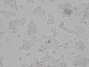 Brightfield micrograph of BT-474, showing adherent growth, 4X magnification.