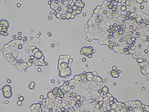 Brightfield micrograph of BT-483, adherent growth, 10X mag.