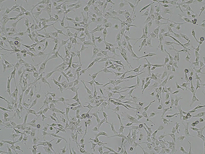 Brightfield micrograph of BT-549, showing adherent growth.