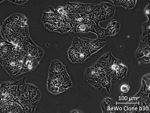 Brightfield micrograph of BeWo Clone b30, showing adherent growth.