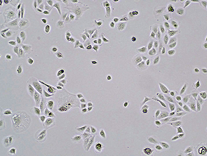 Brightfield micrograph of CAKI-2, showing adherent growth.