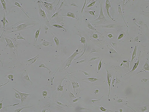 Brightfield micrograph of CCD-18Co, showing adherent growth.