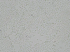 Brightfield micrograph of CKT-1, showing adherent growth, 4X magnification.