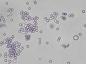 Brightfield micrograph of COLO-205, showing mixed adherent/suspension growth, 10X magnification.