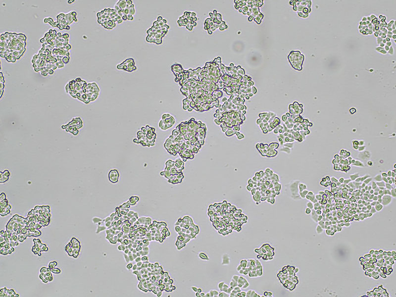 Brightfield micrograph of COLO-668, showing adherent and suspension growth, 4X magnification.