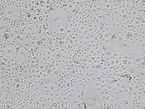 Brightfield micrograph of COS-7, showing adherent growth, 4X magnification.