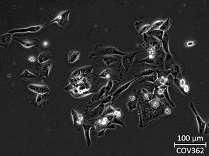 Brightfield micrograph of COV362, showing adherent growth.