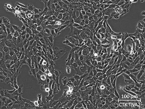 Brightfield micrograph of CTX TNA2, showing adherent growth.