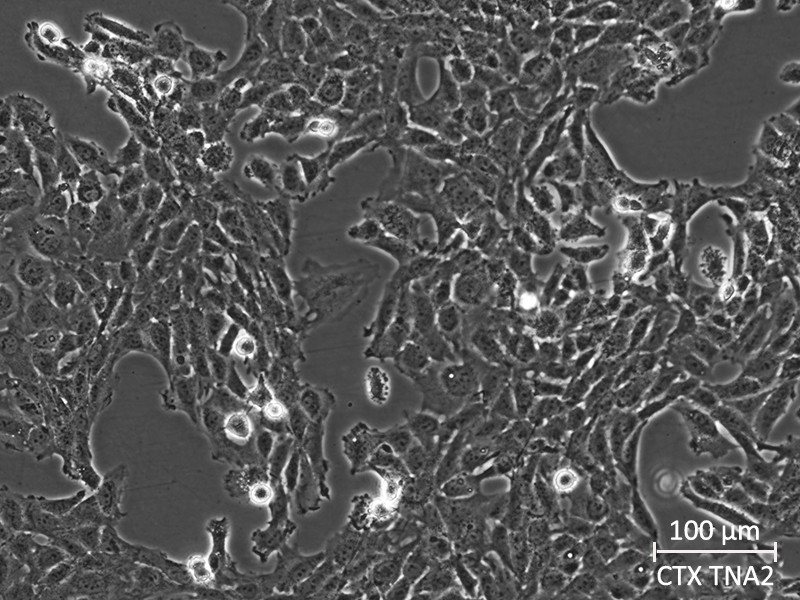 CTX-TNA2 rat type I astrocyte cells exhibit fibroblast-like morphology in adherent culture; Scale bar at bottom right.