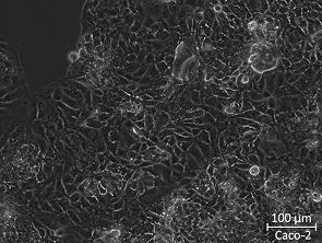 Brightfield micrograph of Caco-2, showing adherent growth.