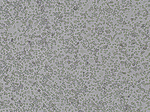 Brightfield micrograph of DH82, showing suspension growth.