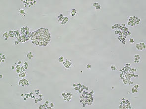 Brightfield micrograph of DMS 53, showing adherent growth, 4X magnification.