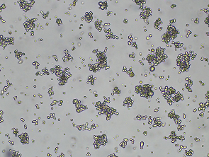 Brightfield micrograph of DMS-79, adherent growth, 4X mag.