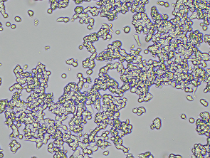 Brightfield micrograph of DMS153, showing suspension growth, 10X magnification.