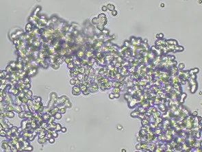 Brightfield micrograph of DU4475, showing suspension growth, 10X magnification.