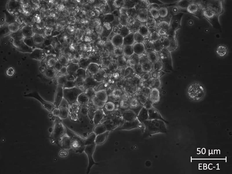 EBC-1 cells