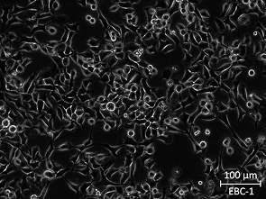 Brightfield micrograph of EBC-1, showing adherent growth.