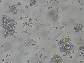 Brightfield micrograph of EoL-1, showing suspension growth.