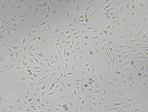 Brightfield micrograph of FTC-133, showing adherent growth, 4X magnification.