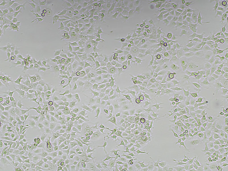 Brightfield micrograph of FaDu, showing adherent growth, 4X magnification.