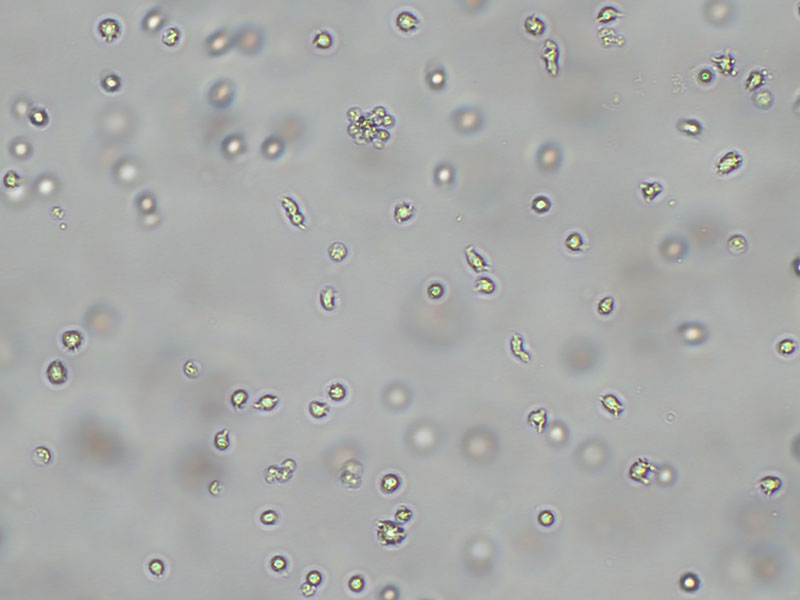 Brightfield micrograph of GDM-1, showing suspension growth, 10X magnification.