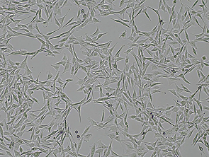 Brightfield micrograph of H1975, showing adherent growth.