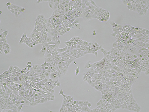 Brightfield micrograph of H441, showing adherent growth, 4X magnification.